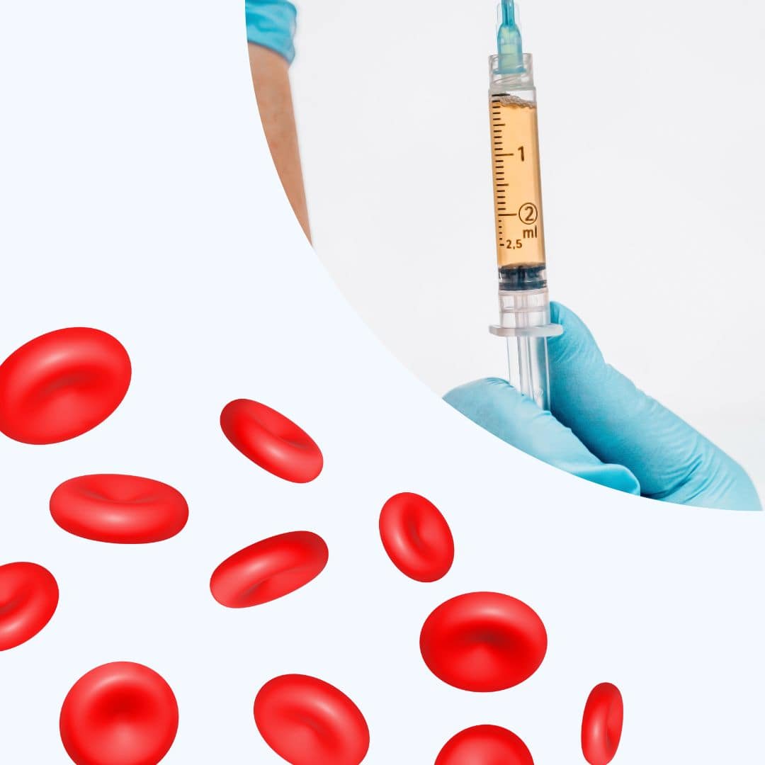 Plasma ricco di piastrine
