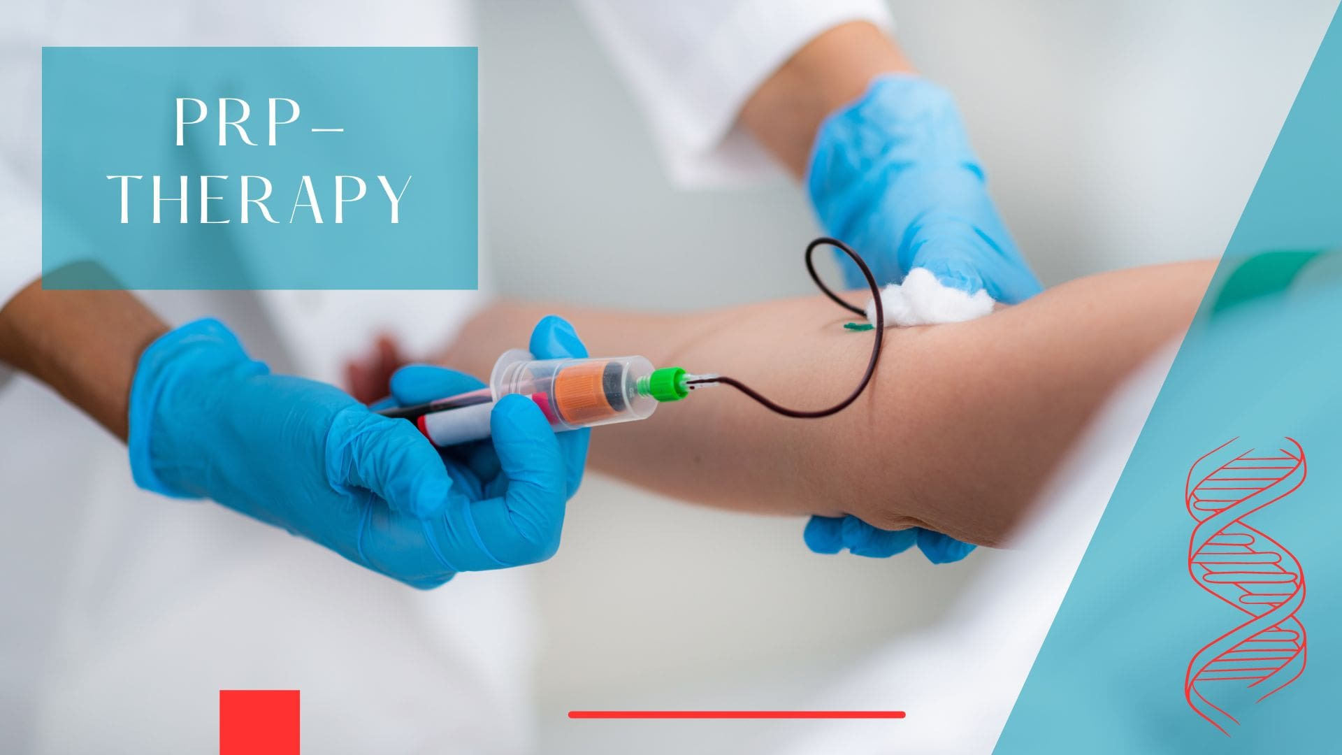 PRP Therapy: A Comprehensive Guide to Basics